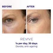 LUSTRE® ClearSkin Revive LED Mask